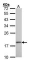 40S ribosomal protein S10 antibody, PA5-21390, Invitrogen Antibodies, Western Blot image 