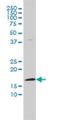 Fragile Histidine Triad Diadenosine Triphosphatase antibody, H00002272-M03, Novus Biologicals, Western Blot image 