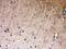 NDRG Family Member 3 antibody, A10017, Boster Biological Technology, Immunohistochemistry frozen image 