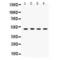 Sulfotransferase Family 2B Member 1 antibody, LS-C408035, Lifespan Biosciences, Western Blot image 