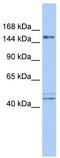 Activity Dependent Neuroprotector Homeobox antibody, TA345170, Origene, Western Blot image 