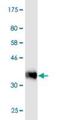 PEAK1 Related, Kinase-Activating Pseudokinase 1 antibody, H00157285-M02, Novus Biologicals, Western Blot image 