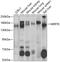 MER Proto-Oncogene, Tyrosine Kinase antibody, 19-665, ProSci, Western Blot image 