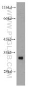 Ankyrin Repeat And SOCS Box Containing 8 antibody, 11735-1-AP, Proteintech Group, Western Blot image 