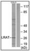 Lecithin Retinol Acyltransferase antibody, AP32252PU-N, Origene, Western Blot image 