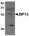 Solute Carrier Family 39 Member 13 antibody, A08928, Boster Biological Technology, Western Blot image 