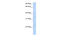 Tumor necrosis factor receptor superfamily member 18 antibody, 31-022, ProSci, Western Blot image 