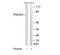 P21 (RAC1) Activated Kinase 5 antibody, TA312680, Origene, Western Blot image 