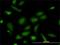Nuclear Distribution C, Dynein Complex Regulator antibody, H00010726-M01, Novus Biologicals, Immunofluorescence image 