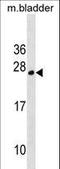 TPD52 Like 1 antibody, LS-C157248, Lifespan Biosciences, Western Blot image 
