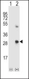 SPARC antibody, GTX81749, GeneTex, Western Blot image 