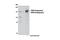 Ubiquitin Specific Peptidase 8 antibody, 8728T, Cell Signaling Technology, Western Blot image 