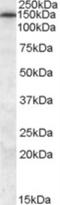 ATP Binding Cassette Subfamily C Member 5 antibody, NB100-94881, Novus Biologicals, Western Blot image 