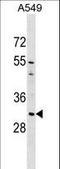 Aquaporin 1 (Colton Blood Group) antibody, LS-B9806, Lifespan Biosciences, Western Blot image 