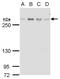 ATM Serine/Threonine Kinase antibody, MA1-23152, Invitrogen Antibodies, Western Blot image 