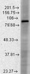 Hyperpolarization Activated Cyclic Nucleotide Gated Potassium Channel 3 antibody, GTX41987, GeneTex, Western Blot image 