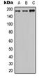 ATP Binding Cassette Subfamily C Member 2 antibody, MBS820348, MyBioSource, Western Blot image 