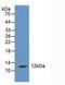 CASP2 And RIPK1 Domain Containing Adaptor With Death Domain antibody, LS-C305235, Lifespan Biosciences, Western Blot image 