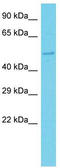 F-Box And WD Repeat Domain Containing 12 antibody, TA332170, Origene, Western Blot image 