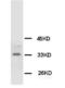 SMAD Family Member 4 antibody, orb18265, Biorbyt, Western Blot image 