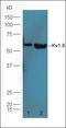 NFKB Inhibitor Alpha antibody, orb338946, Biorbyt, Western Blot image 