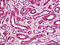 Lysosomal acid phosphatase antibody, 51-669, ProSci, Immunohistochemistry paraffin image 