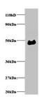 Alpha-1-acid glycoprotein antibody, orb243820, Biorbyt, Western Blot image 