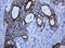 Keratin 5 antibody, LS-C175541, Lifespan Biosciences, Immunohistochemistry paraffin image 