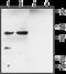 Potassium Calcium-Activated Channel Subfamily M Regulatory Beta Subunit 2 antibody, GTX16645, GeneTex, Western Blot image 