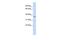 Leucine Rich Repeat Containing 25 antibody, GTX45692, GeneTex, Western Blot image 