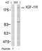 Insulin Like Growth Factor 1 Receptor antibody, A00070-1, Boster Biological Technology, Western Blot image 