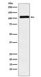 Mindbomb E3 Ubiquitin Protein Ligase 1 antibody, M01387-1, Boster Biological Technology, Western Blot image 