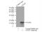 CD247 Molecule antibody, 12837-2-AP, Proteintech Group, Immunoprecipitation image 