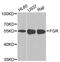 FGR Proto-Oncogene, Src Family Tyrosine Kinase antibody, MBS126601, MyBioSource, Western Blot image 