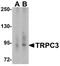 Transient Receptor Potential Cation Channel Subfamily C Member 3 antibody, A01472-3, Boster Biological Technology, Western Blot image 