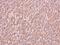 ADP-Ribosyltransferase 5 antibody, PA5-28544, Invitrogen Antibodies, Immunohistochemistry frozen image 