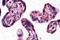 Dickkopf WNT Signaling Pathway Inhibitor 1 antibody, GTX89683, GeneTex, Immunohistochemistry paraffin image 