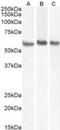 TACO antibody, NB100-1298, Novus Biologicals, Western Blot image 