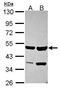 SET And MYND Domain Containing 2 antibody, PA5-30732, Invitrogen Antibodies, Western Blot image 