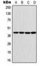 G Protein Subunit Alpha I1 antibody, LS-C352250, Lifespan Biosciences, Western Blot image 