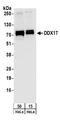 DEAD-Box Helicase 17 antibody, NB200-352, Novus Biologicals, Western Blot image 