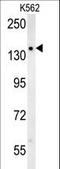 Solute Carrier Family 12 Member 5 antibody, LS-C161128, Lifespan Biosciences, Western Blot image 