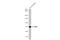 Peptidyl Arginine Deiminase 4 antibody, GTX113945, GeneTex, Western Blot image 