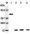 Resistin antibody, ALX-804-524-C050, Enzo Life Sciences, Western Blot image 