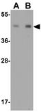 NK2 Homeobox 1 antibody, GTX31847, GeneTex, Western Blot image 