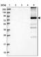 Glycogen Synthase 2 antibody, NBP1-91191, Novus Biologicals, Immunohistochemistry frozen image 