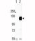 EPH Receptor A2 antibody, F50562-0.4ML, NSJ Bioreagents, Western Blot image 