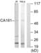 Zinc Finger HIT-Type Containing 6 antibody, abx015028, Abbexa, Western Blot image 