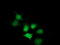 Stp antibody, TA501952, Origene, Immunofluorescence image 