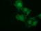 NSE2 (MMS21) Homolog, SMC5-SMC6 Complex SUMO Ligase antibody, GTX83996, GeneTex, Immunofluorescence image 